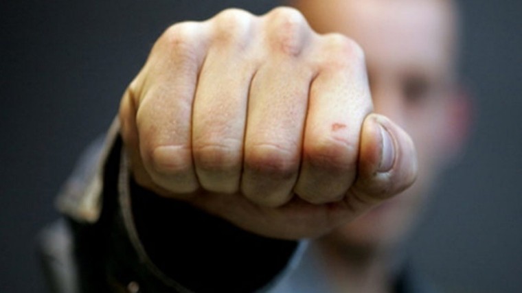 Прокурора избили во дворе его дома в ХМАО