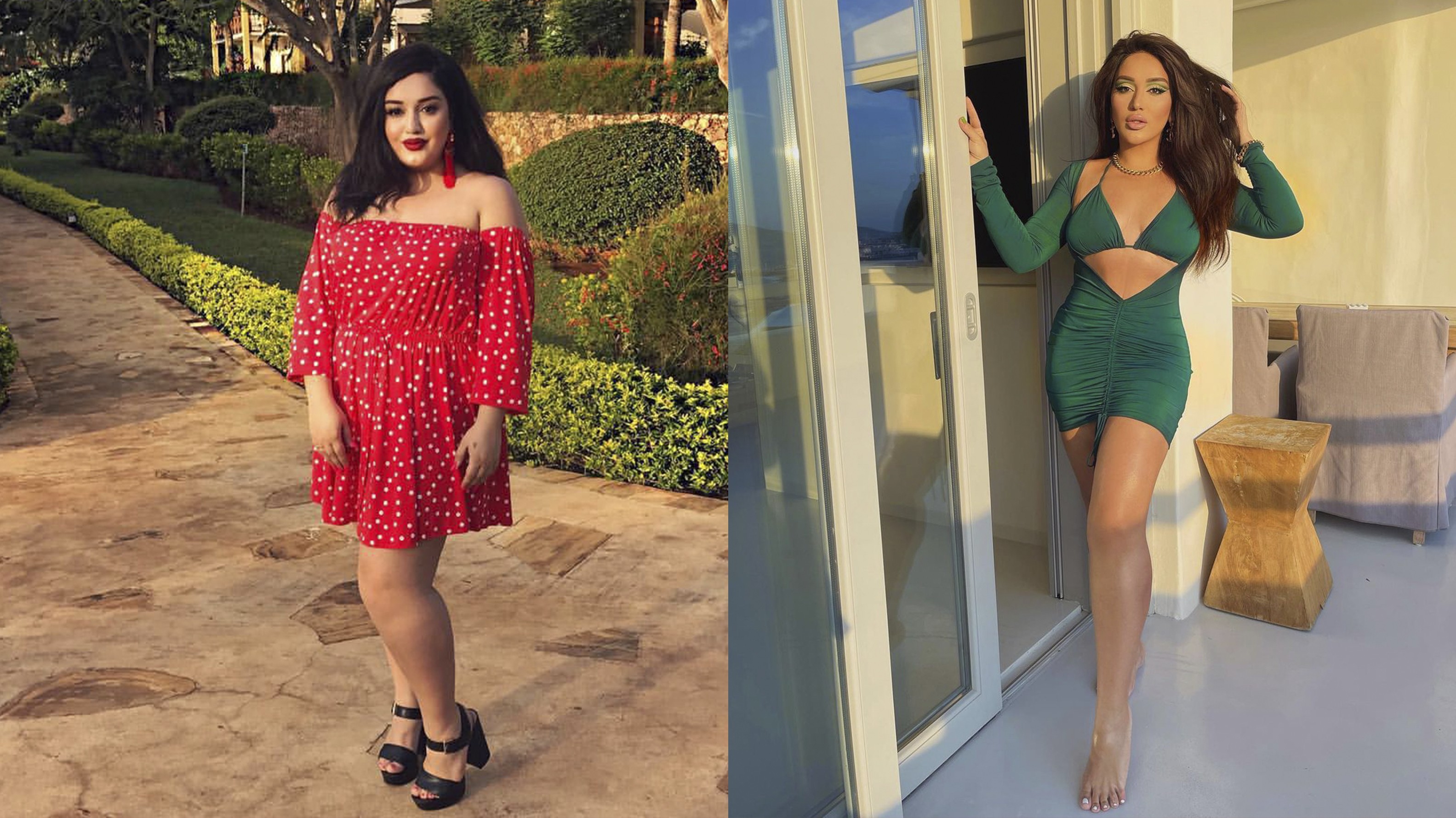 Фото Как выглядит Гоар Аветисян до и после похудения