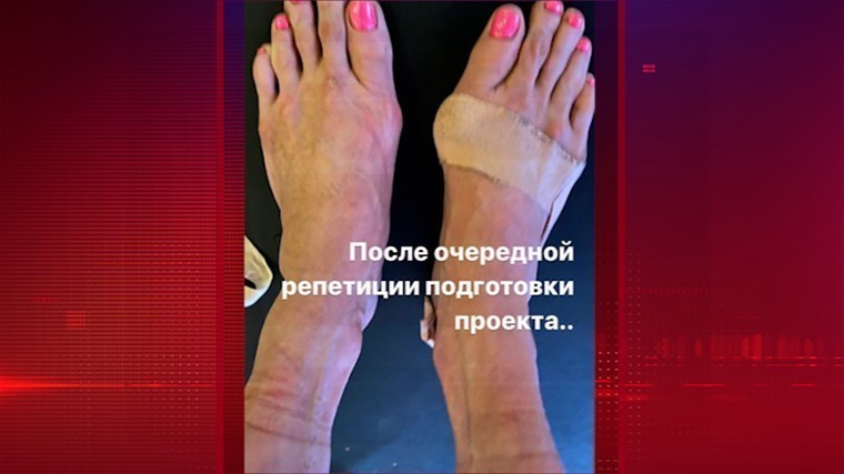 Мази бесполезны: что грозит ногам Волочковой, истерзанным балетом?