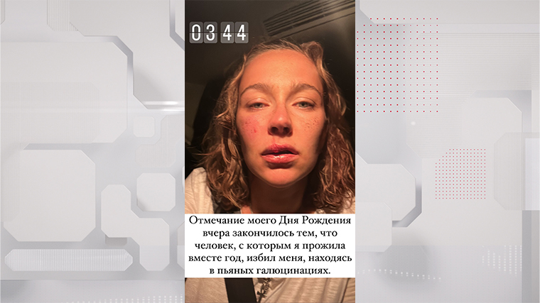 Татьяну Виноградову жестко избил ее парень