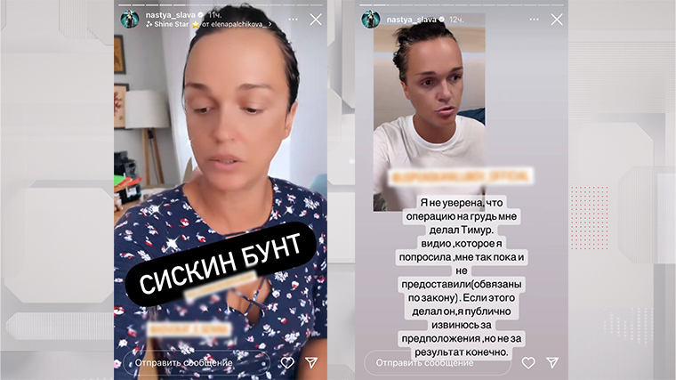 Певица Слава отреагировала на обвинения Добровинского о недовольных пациентках после пластики