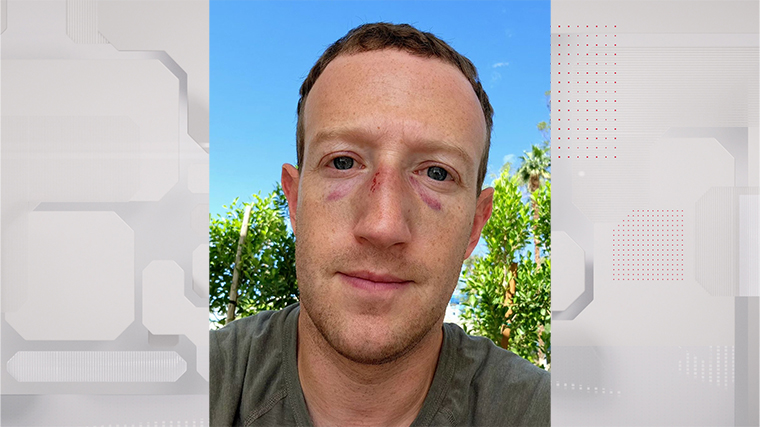Цукерберг показал фото с избитым лицом на фоне слухов о бое с Маском