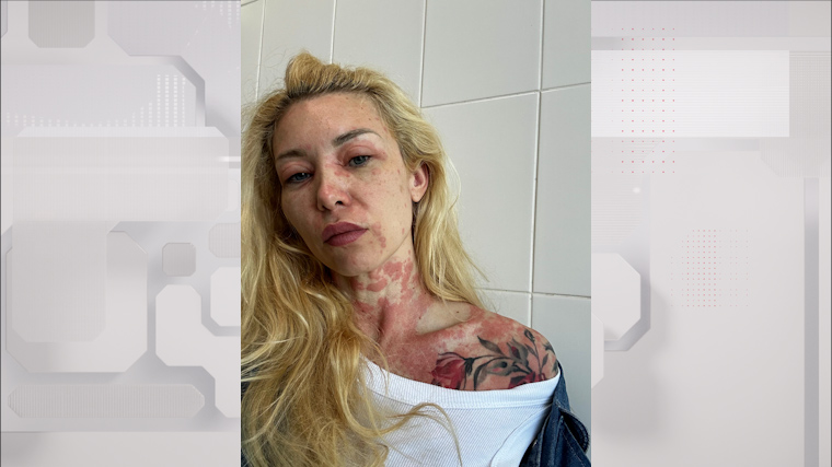 &laquo;Я&nbsp;отекший шар&raquo;: отпуск закончился реанимацией для дочери Мстислава Запашного