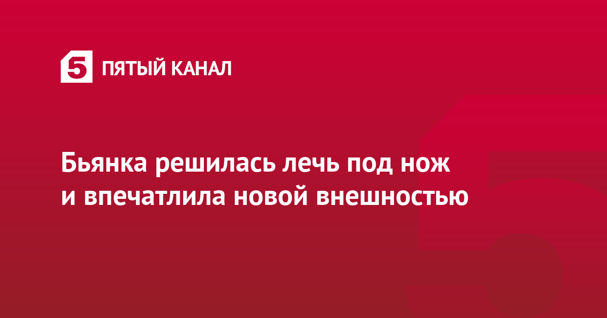 Бьянка решилась лечь под нож и впечатлила новой внешностью