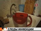 В Свердловской области в городском водопроводе обнаружен вирус гепатита