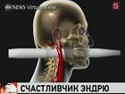 Американский водитель выжил несмотря на смертельно опасную травму