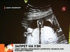 Совет Европы хочет запретить родителям узнавать пол будущего ребёнка