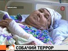 В Чувашии на 70-летнюю женщину спустили собак-убийц