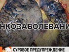 Минздравсоцразвития утвердило макеты фотографий, которые скоро появятся на пачках сигарет