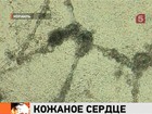 Израильские ученые смогли создать здоровые клетки сердца из кожи