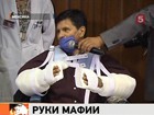 Уникальная операция в Мексике: рабочему пришили руки мёртвого мафиози