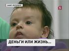 Четырехмесячной Свете требуется срочная помощь