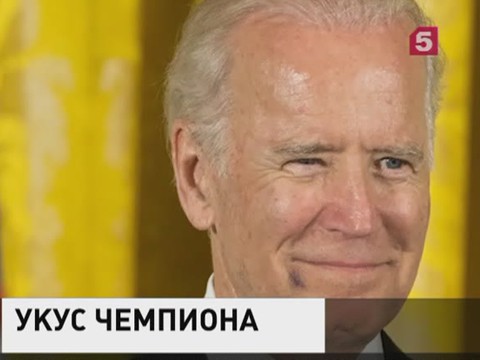 Вице-президент США Джо Байден появился на публике с синяком на лице