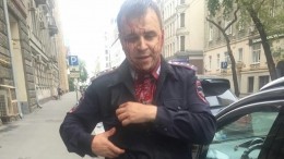 Мужчина 7 раз ударил ножом полицейского у посольства Словакии в Москве — фото