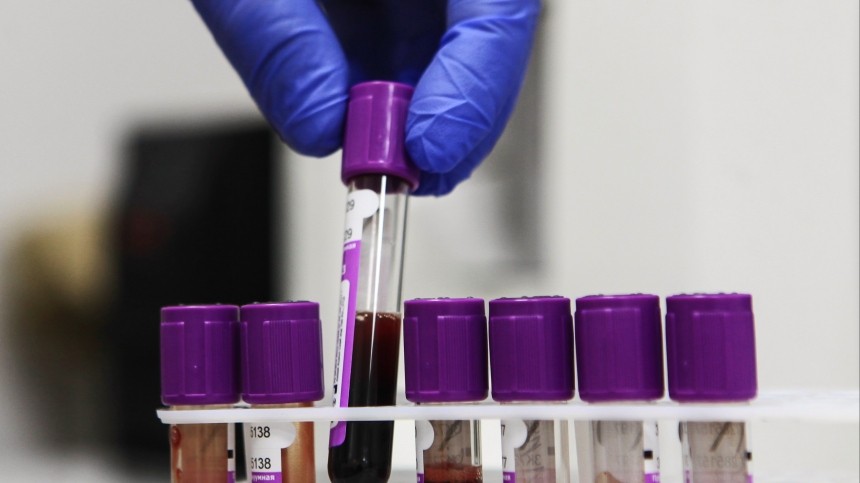 Приближение смерти поможет установить анализ крови — немецкие ученые