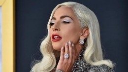 Леди Гага показала рентгеновский снимок руки после падения со сцены