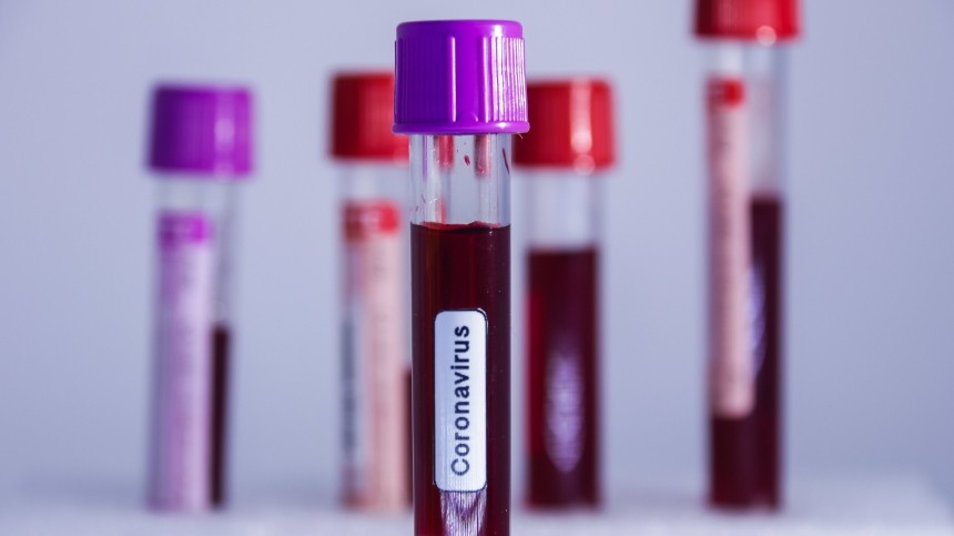 В Москве донорам крови с антителами на COVID-19 назначат социальные выплаты