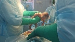 Врачи спасли беременную иркутянку со стопроцентным поражением легких — видео