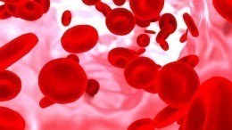 Как по группе крови вычислить склонность к инфаркту и инсульту