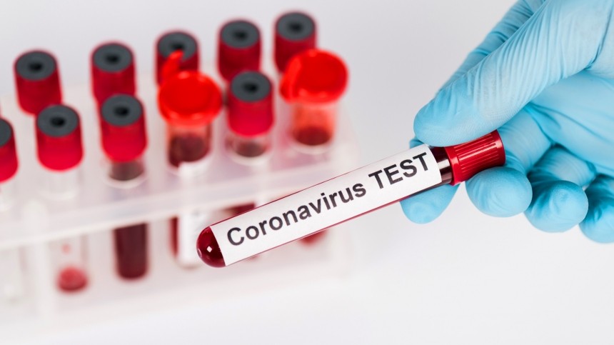 Роспотребнадзор презентовал уникальный тест для оценки степени заразности COVID