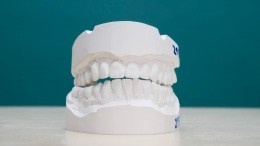 В Запорожье засыпали яму на дороге гипсовыми слепками челюстей