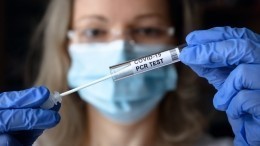 Роспотребнадзор сократил максимальный срок предоставления тестов на коронавирус