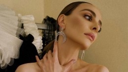 Дорогие женщины: как «пластика» и деньги изменили звезд российского шоу-бизнеса