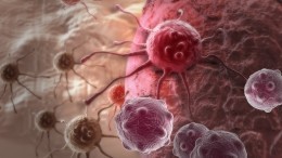 Плохие гены: насколько велик риск получить рак по наследству от родственников