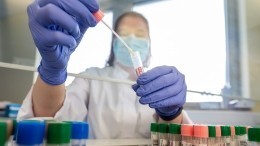 Гепрокуратура проверит обоснованность цен ПЦР-тестов на коронавирус
