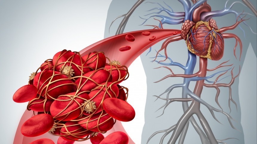Врач предупредил о проблемах со свертываемостью крови после «омикрона»