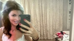 Экс-супруга Андрея Аршавина показала фото после операции по восстановлению носа
