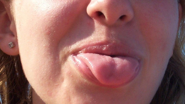 Смертельная тяга: какие симптомы говорят о развитии рака языка и полости рта