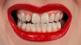 Знак беды или счастья: ТОП самых популярных примет с зубами