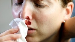 Может ли носовое кровотечение привести к быстрой смерти — ответ врача