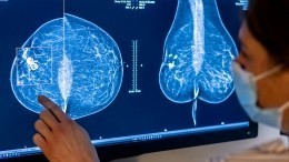 Рак молочной железы: кто из женщин в группе риска?