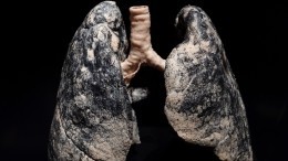 Что происходит в легких после отказа от курения? Ответ врача
