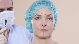 Изуродовавший лицо модели из Сочи пластический хирург предстанет перед судом