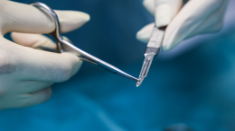 Это прорыв: российские хирурги провели уникальную операцию по протезированию брюшного отдела аорты