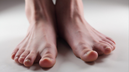 Билет в инвалидность: признаки высокого холестерина на пальцах ног, предвещающие ампутацию