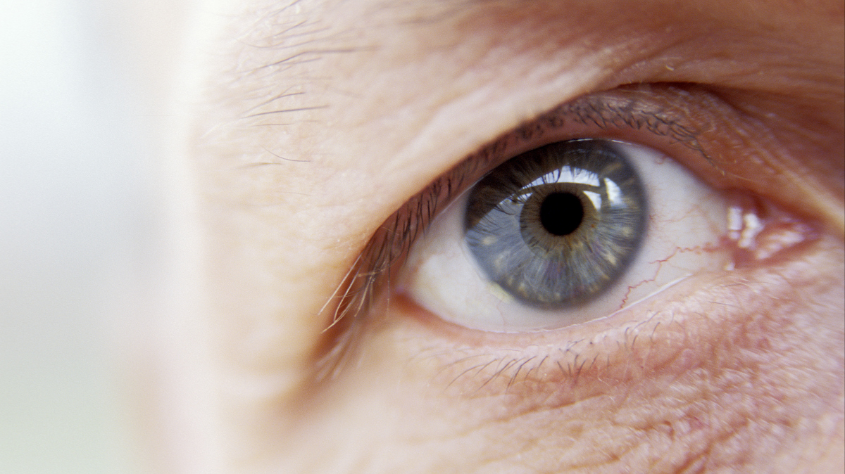 Глазной тик: причины, симптомы, способы лечения