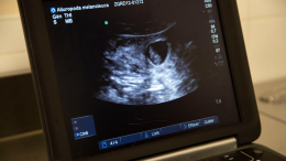«Есть право»: в Госдуме предложили законодательно закрепить статус эмбриона