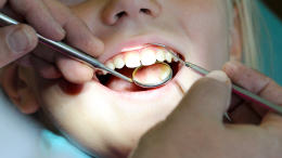 Тайна стоматологов: как предотвратить проблемы с зубами у детей