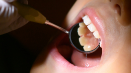 Воспаление, кариес и не только: как стресс влияет на здоровье зубов