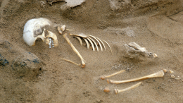 Скелет с «фарфоровым» желчным пузырем нашли на кладбище психбольницы в США