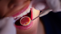 Изо рта в рот: стоматолог рассказал, можно ли заразиться кариесом