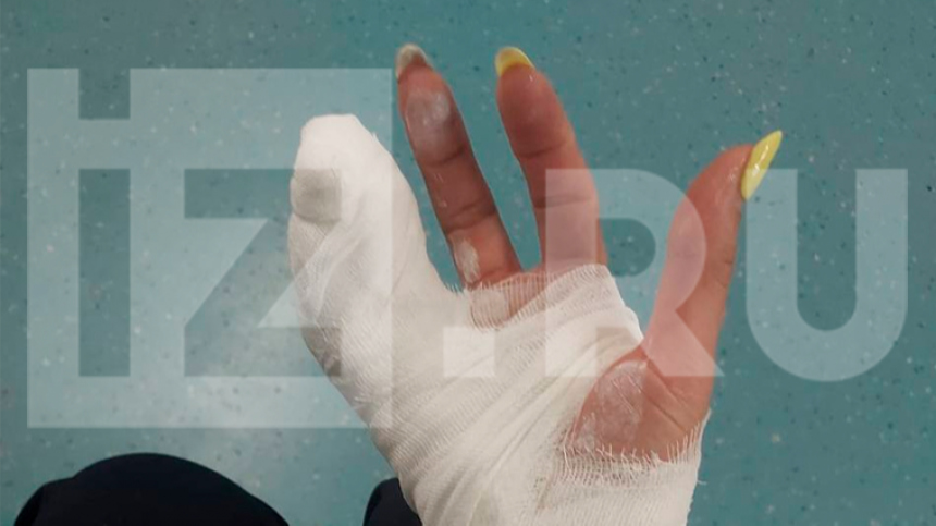 Женщине откусили палец в петербургском фитнес-клубе