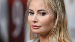 Дана Борисова не стесняется своего шрама после пластической операции
