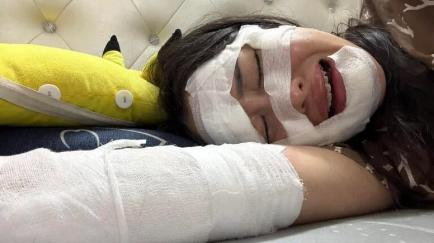 Едва не ослепла: блогер получила жуткие ожоги глаз в день рождения