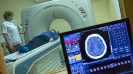 Хирург назвал главные сигналы приближения инсульта