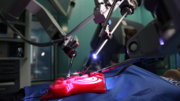 Аналогов нет: операционная с ИИ заработала в Тюмени